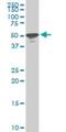 Serine/Threonine Kinase 38 antibody, H00011329-M05, Novus Biologicals, Immunocytochemistry image 