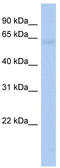 Outer Dense Fiber Of Sperm Tails 2 Like antibody, TA336157, Origene, Western Blot image 