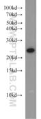 RAB8A, Member RAS Oncogene Family antibody, 55296-1-AP, Proteintech Group, Western Blot image 