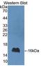 Interferon Gamma antibody, LS-C373900, Lifespan Biosciences, Western Blot image 