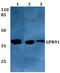 Succinate Receptor 1 antibody, GTX57745, GeneTex, Western Blot image 