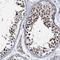 Zinc Finger Protein 609 antibody, NBP1-92634, Novus Biologicals, Immunohistochemistry paraffin image 