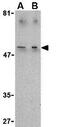 T Cell Immunoglobulin And Mucin Domain Containing 4 antibody, GTX31298, GeneTex, Western Blot image 
