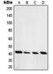Protein Kinase CAMP-Dependent Type I Regulatory Subunit Alpha antibody, orb214438, Biorbyt, Western Blot image 