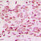 Nuclear Factor Kappa B Subunit 2 antibody, LS-C356224, Lifespan Biosciences, Immunohistochemistry paraffin image 