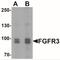 Fibroblast Growth Factor Receptor 3 antibody, NBP2-41227, Novus Biologicals, Western Blot image 