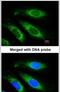 ETFB antibody, PA5-22005, Invitrogen Antibodies, Immunofluorescence image 