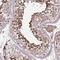 Zinc Finger Protein 624 antibody, NBP2-48561, Novus Biologicals, Immunohistochemistry frozen image 