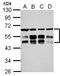 Zinc finger FYVE domain-containing protein 19 antibody, NBP2-20951, Novus Biologicals, Western Blot image 