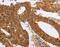 Proteasome 26S Subunit, Non-ATPase 8 antibody, MBS2517598, MyBioSource, Immunohistochemistry frozen image 