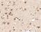 Serine/Threonine Kinase 39 antibody, NBP1-76957, Novus Biologicals, Immunohistochemistry frozen image 