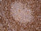 Chitinase Acidic antibody, LS-C795837, Lifespan Biosciences, Immunohistochemistry paraffin image 