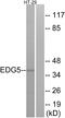 Sphingosine-1-Phosphate Receptor 2 antibody, GTX87713, GeneTex, Western Blot image 