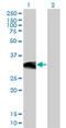 BAF Chromatin Remodeling Complex Subunit BCL11A antibody, LS-B6033, Lifespan Biosciences, Western Blot image 