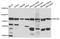 ATP Binding Cassette Subfamily B Member 8 antibody, A2653, ABclonal Technology, Western Blot image 