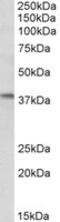 Interferon-inducible protein AIM2 antibody, 43-432, ProSci, Western Blot image 