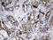 Ribonucleotide Reductase Regulatory Subunit M2 antibody, M01978-1, Boster Biological Technology, Immunohistochemistry paraffin image 