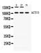 Actinin Alpha 3 (Gene/Pseudogene) antibody, PA5-78720, Invitrogen Antibodies, Western Blot image 
