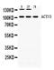 Actinin Alpha 3 (Gene/Pseudogene) antibody, PA5-78720, Invitrogen Antibodies, Western Blot image 