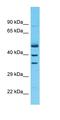 Zinc Finger Protein 528 antibody, orb325351, Biorbyt, Western Blot image 