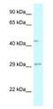 Fucosyltransferase 8 antibody, NBP1-79869, Novus Biologicals, Western Blot image 