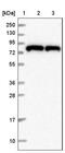 HPS6 Biogenesis Of Lysosomal Organelles Complex 2 Subunit 3 antibody, NBP2-14100, Novus Biologicals, Western Blot image 