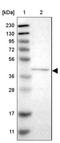 Hyaluronan And Proteoglycan Link Protein 1 antibody, NBP1-85443, Novus Biologicals, Western Blot image 