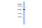 Zinc Finger Protein 71 antibody, NBP1-80358, Novus Biologicals, Western Blot image 