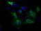 Ubiquitin Specific Peptidase 5 antibody, MA5-25139, Invitrogen Antibodies, Immunocytochemistry image 