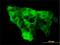 WW Domain Containing E3 Ubiquitin Protein Ligase 1 antibody, H00011059-M01, Novus Biologicals, Immunocytochemistry image 