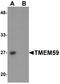 Transmembrane Protein 59 antibody, A09364, Boster Biological Technology, Western Blot image 