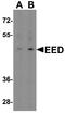 Polycomb protein EED antibody, A01345, Boster Biological Technology, Western Blot image 