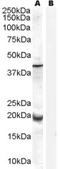 Glutathione Peroxidase 7 antibody, orb19266, Biorbyt, Western Blot image 