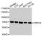 Transient Receptor Potential Cation Channel Subfamily V Member 6 antibody, STJ25977, St John