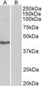 TATA-Box Binding Protein antibody, TA311260, Origene, Western Blot image 