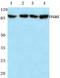 Integrin Subunit Beta 5 antibody, A04201, Boster Biological Technology, Western Blot image 