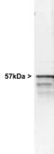 Peripherin antibody, LS-C204575, Lifespan Biosciences, Western Blot image 