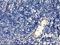 Centromere Protein H antibody, NBP2-01449, Novus Biologicals, Immunohistochemistry frozen image 