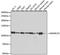 SWI/SNF Related, Matrix Associated, Actin Dependent Regulator Of Chromatin, Subfamily A, Member 5 antibody, A2000, ABclonal Technology, Western Blot image 