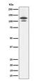 RAS P21 Protein Activator 1 antibody, M01929-1, Boster Biological Technology, Western Blot image 