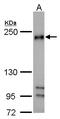 RB1 Inducible Coiled-Coil 1 antibody, GTX107387, GeneTex, Western Blot image 