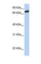 Leucine Rich Repeats And Calponin Homology Domain Containing 4 antibody, NBP1-69265, Novus Biologicals, Western Blot image 