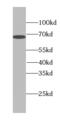 Transketolase antibody, FNab08939, FineTest, Western Blot image 