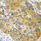 Adenylate kinase isoenzyme 1 antibody, LS-C331362, Lifespan Biosciences, Immunohistochemistry paraffin image 