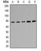 Cytochrome P450 Oxidoreductase antibody, orb381969, Biorbyt, Western Blot image 