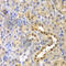 Glyoxalase I antibody, A1932, ABclonal Technology, Immunohistochemistry paraffin image 