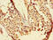 Leucine Zipper Transcription Factor Like 1 antibody, CSB-PA885687LA01HU, Cusabio, Immunohistochemistry paraffin image 