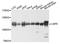 Ubiquitin Specific Peptidase 5 antibody, A4202, ABclonal Technology, Western Blot image 