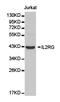 Interleukin 2 Receptor Subunit Gamma antibody, TA327191, Origene, Western Blot image 