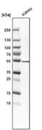Serine Hydroxymethyltransferase 1 antibody, NBP1-85437, Novus Biologicals, Western Blot image 
